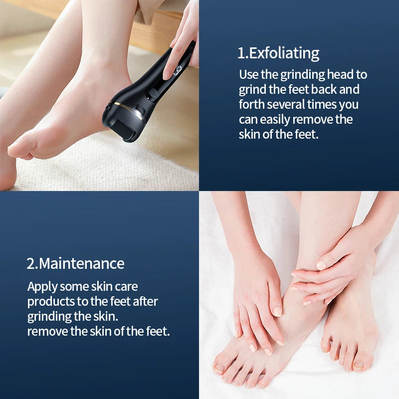 Rechargeable Electric Foot Grinder - USB Powered Callus Remover with Adjustable Speeds, for Men & Women's Pedicure and Self-Care