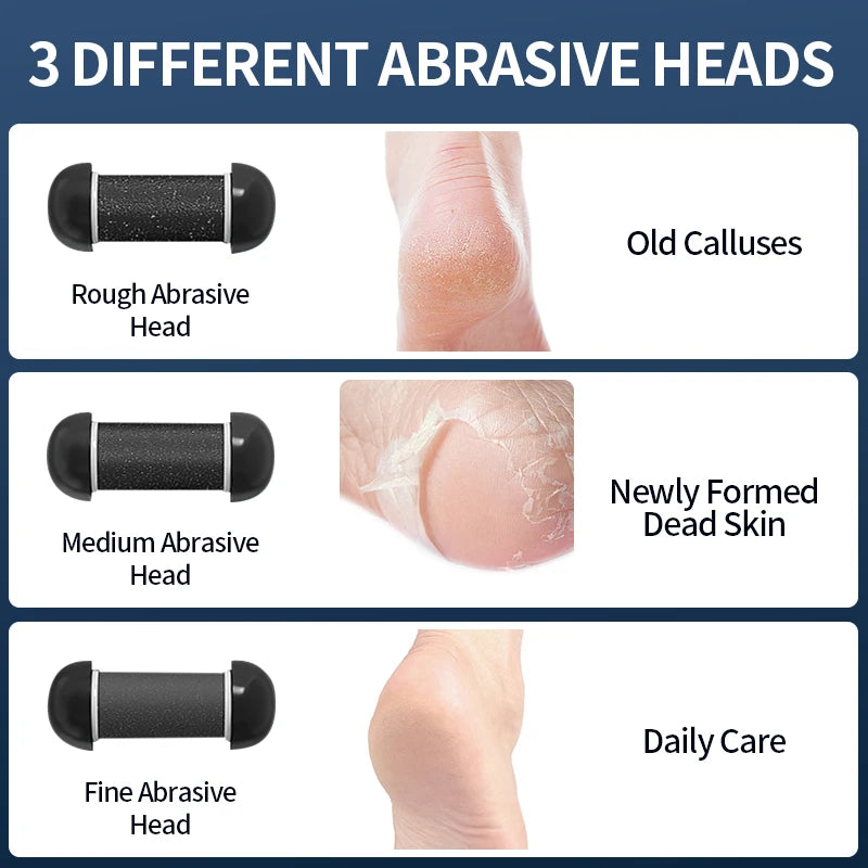 Rechargeable Electric Foot Grinder - USB Powered Callus Remover with Adjustable Speeds, for Men & Women's Pedicure and Self-Care